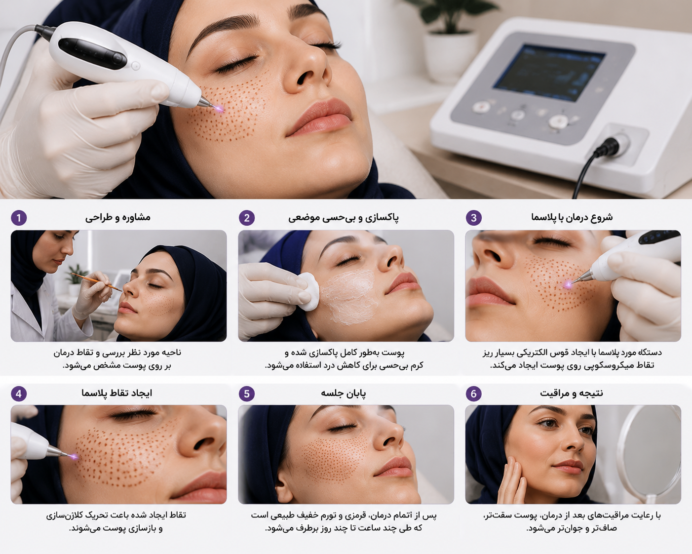 پلاسما تراپی