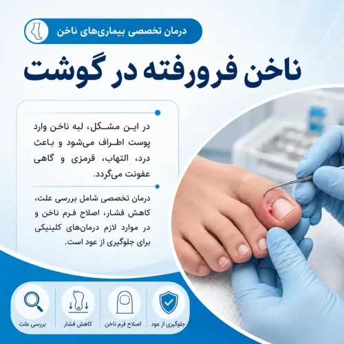 ناخن فرو رفته در گوشت