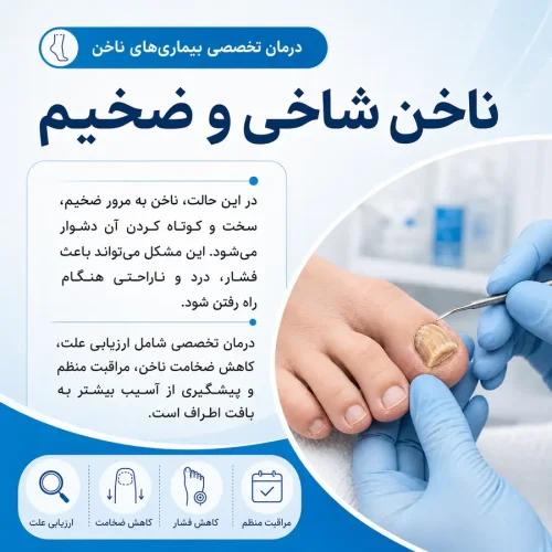 ناخن شاخی و ضخیم